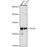 Western Blot - Anti-Calretinin Antibody (A16338) - Antibodies.com