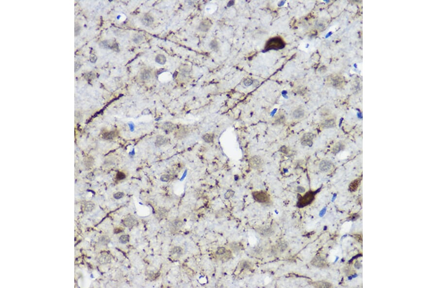 Immunohistochemistry - Anti-Calretinin Antibody (A16338) - Antibodies.com