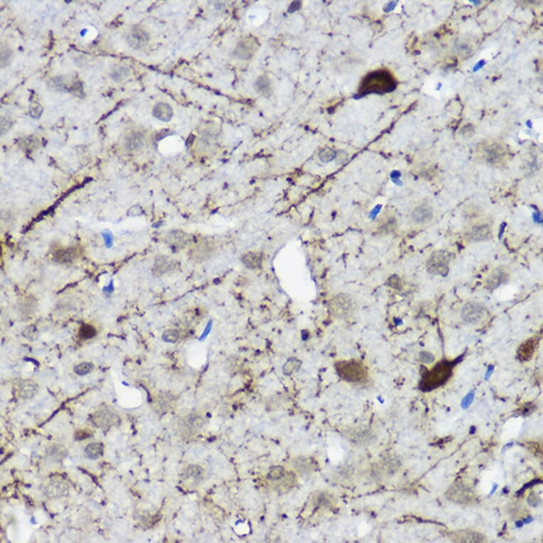 Immunohistochemistry - Anti-Calretinin Antibody (A16338) - Antibodies.com