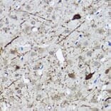 Immunohistochemistry - Anti-Calretinin Antibody (A16338) - Antibodies.com