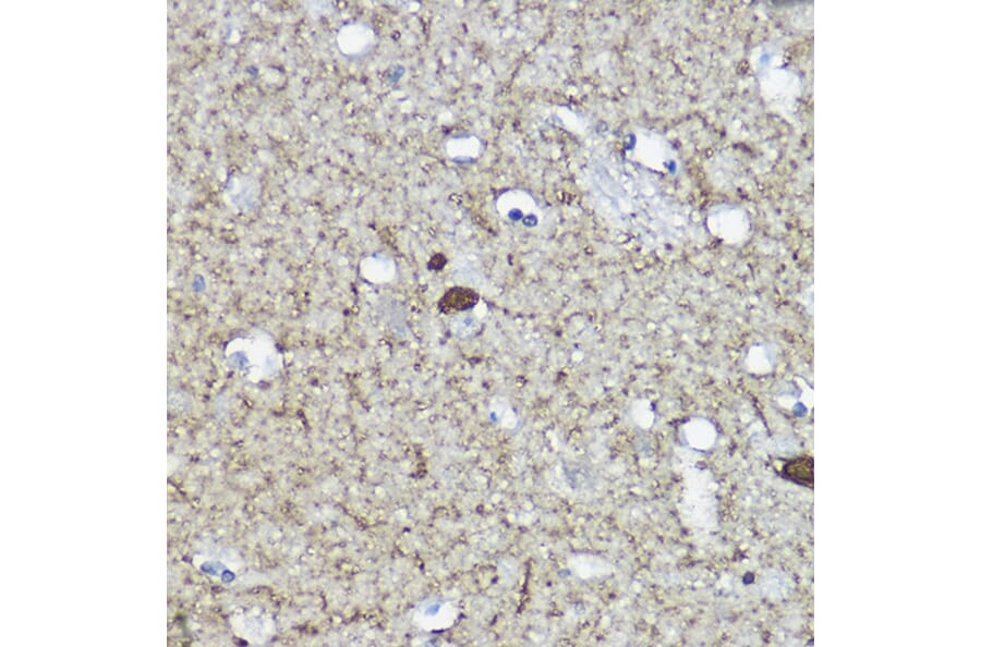 Immunohistochemistry - Anti-Calretinin Antibody (A16338) - Antibodies.com