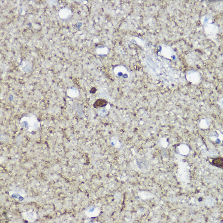 Immunohistochemistry - Anti-Calretinin Antibody (A16338) - Antibodies.com