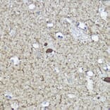 Immunohistochemistry - Anti-Calretinin Antibody (A16338) - Antibodies.com