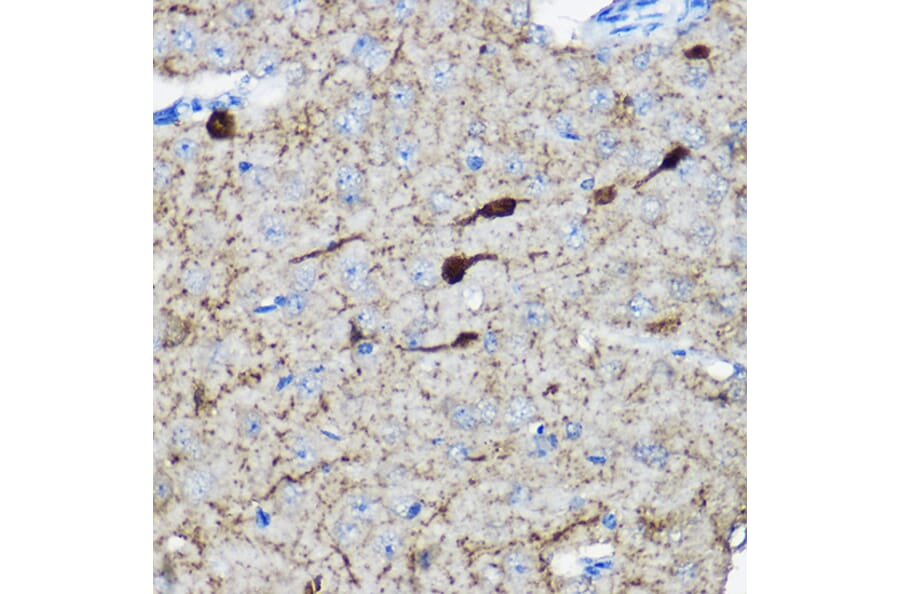 Immunohistochemistry - Anti-Calretinin Antibody (A16338) - Antibodies.com