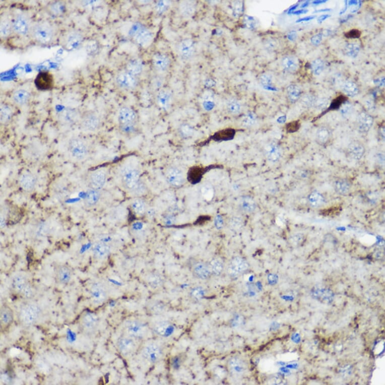 Immunohistochemistry - Anti-Calretinin Antibody (A16338) - Antibodies.com