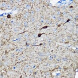 Immunohistochemistry - Anti-Calretinin Antibody (A16338) - Antibodies.com