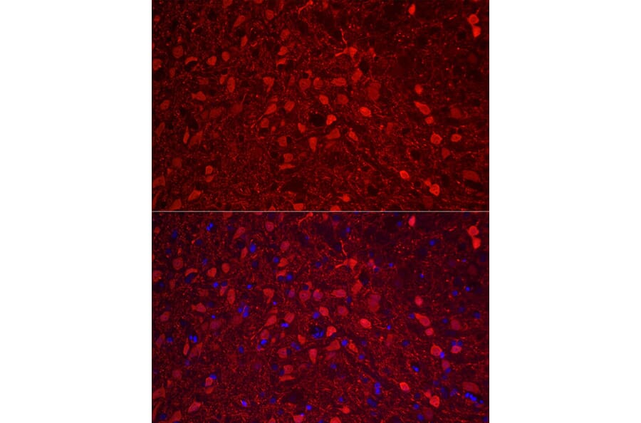 Immunofluorescence - Anti-Calretinin Antibody (A16338) - Antibodies.com