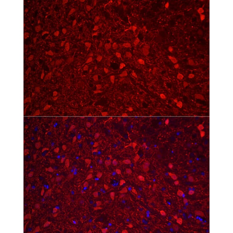 Immunofluorescence - Anti-Calretinin Antibody (A16338) - Antibodies.com