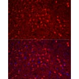 Immunofluorescence - Anti-Calretinin Antibody (A16338) - Antibodies.com