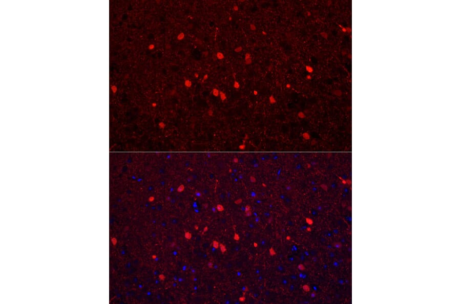 Immunofluorescence - Anti-Calretinin Antibody (A16338) - Antibodies.com