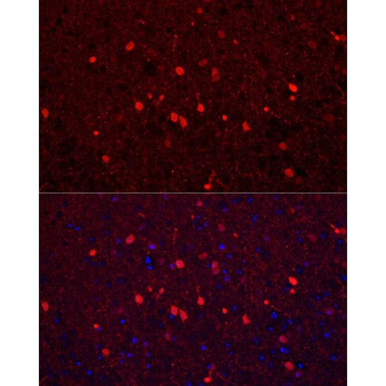 Immunofluorescence - Anti-Calretinin Antibody (A16338) - Antibodies.com