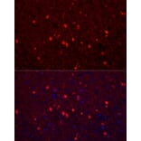 Immunofluorescence - Anti-Calretinin Antibody (A16338) - Antibodies.com