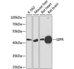 Western Blot - Anti-GIPR Antibody (A16339) - Antibodies.com