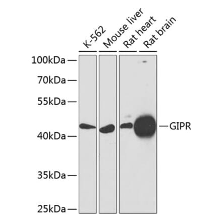 Western Blot - Anti-GIPR Antibody (A16339) - Antibodies.com