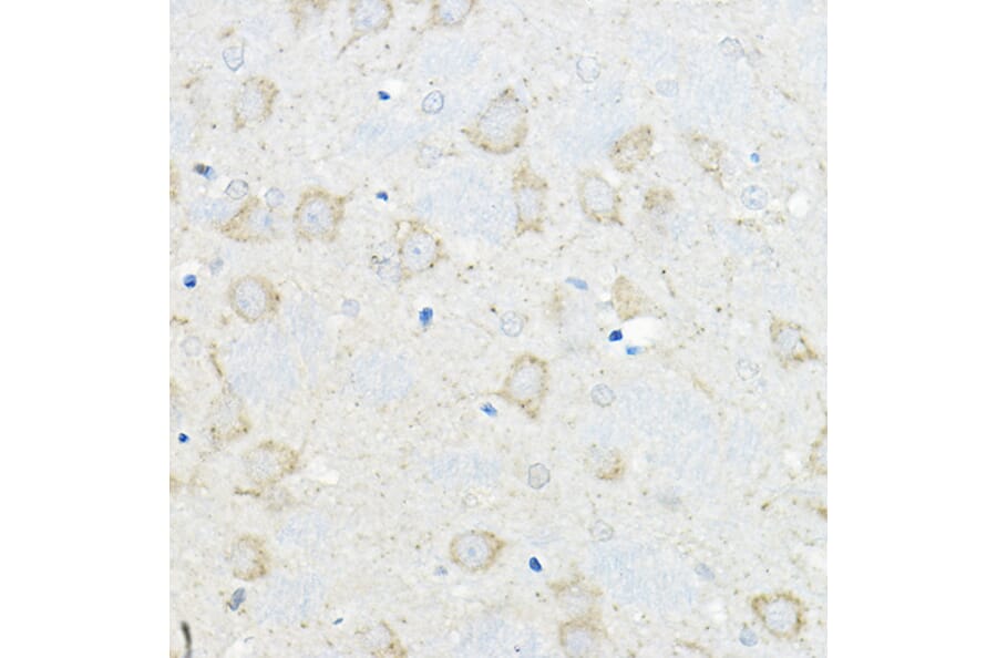 Immunohistochemistry - Anti-GIPR Antibody (A16339) - Antibodies.com