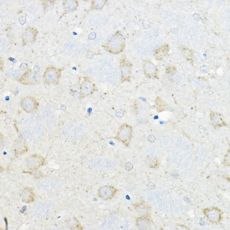 Immunohistochemistry - Anti-GIPR Antibody (A16339) - Antibodies.com