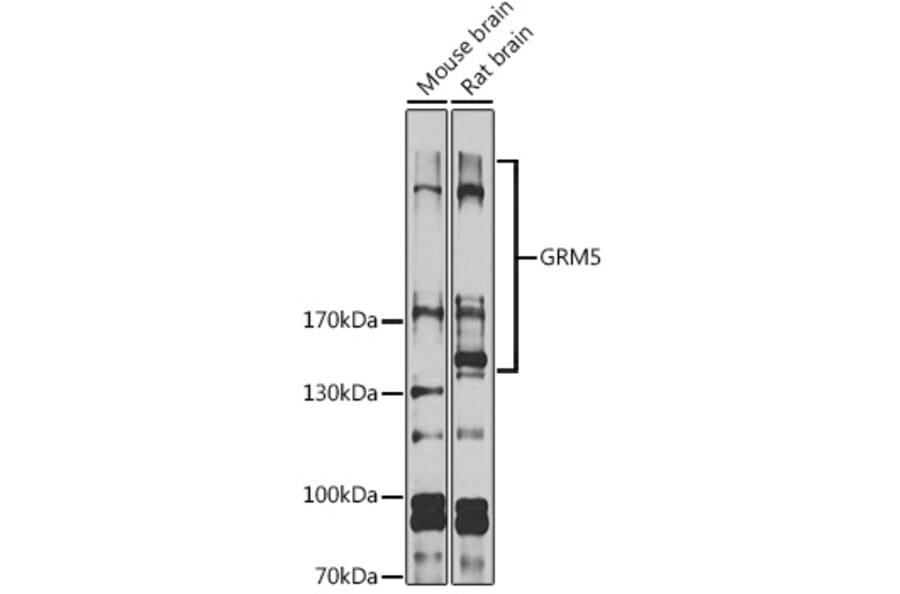Western Blot - Anti-Metabotropic Glutamate Receptor 5 Antibody (A16340) - Antibodies.com