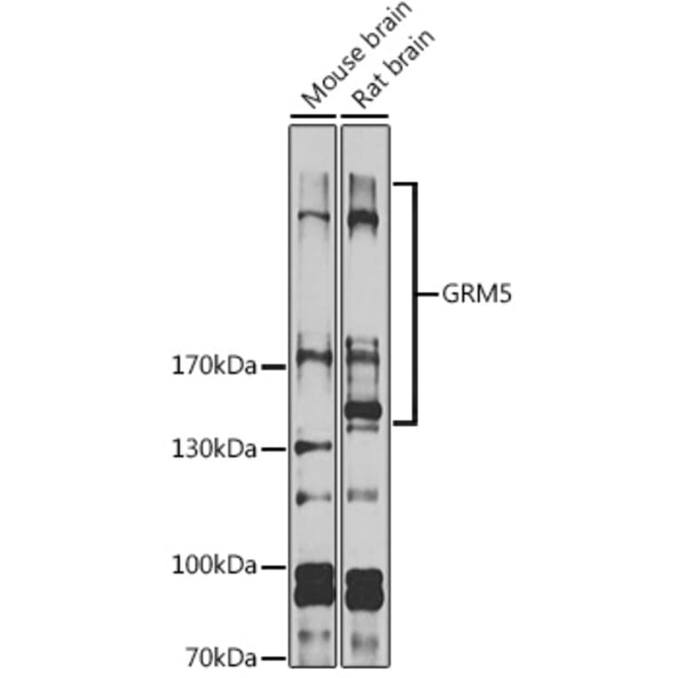 Western Blot - Anti-Metabotropic Glutamate Receptor 5 Antibody (A16340) - Antibodies.com