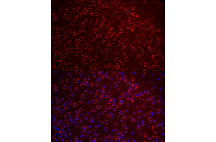 Immunofluorescence - Anti-Metabotropic Glutamate Receptor 5 Antibody (A16340) - Antibodies.com