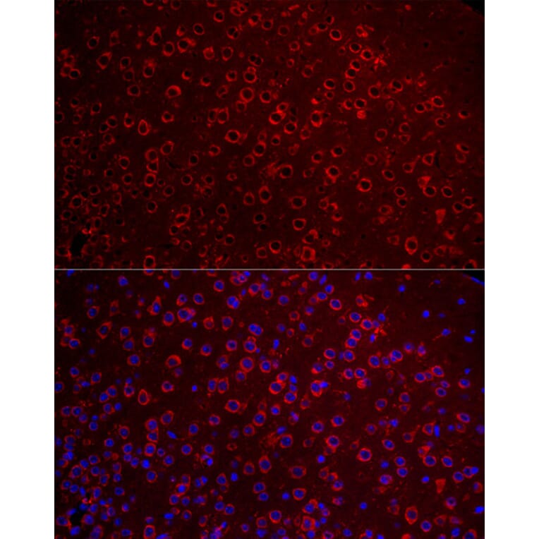 Immunofluorescence - Anti-Metabotropic Glutamate Receptor 5 Antibody (A16340) - Antibodies.com