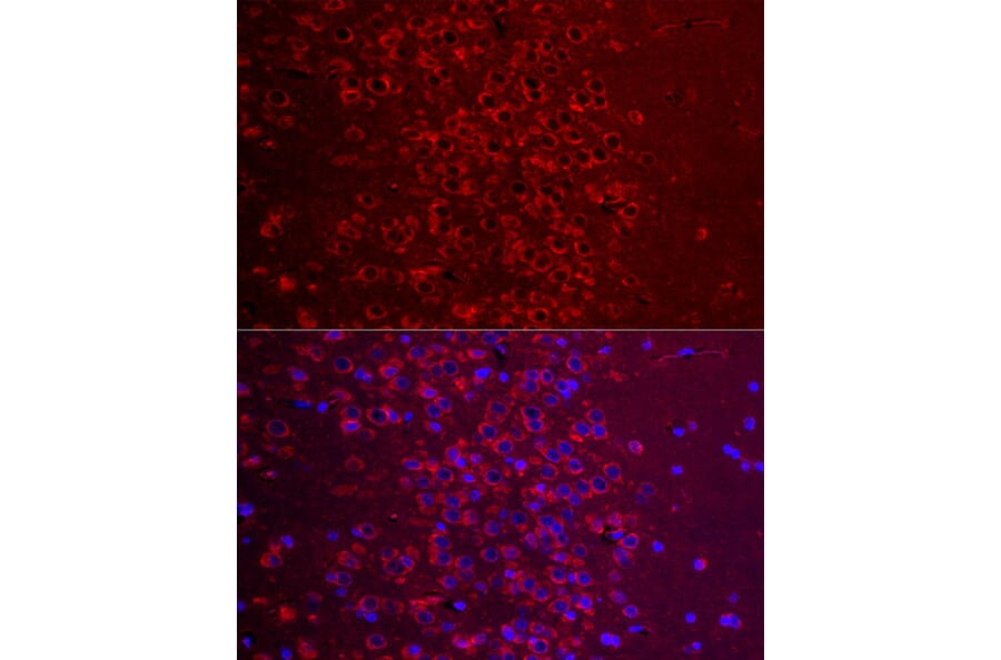 Immunofluorescence - Anti-Metabotropic Glutamate Receptor 5 Antibody (A16340) - Antibodies.com