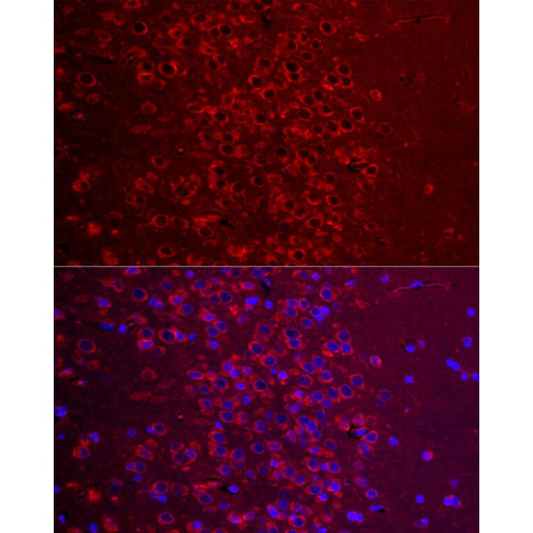 Immunofluorescence - Anti-Metabotropic Glutamate Receptor 5 Antibody (A16340) - Antibodies.com