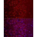 Immunofluorescence - Anti-Metabotropic Glutamate Receptor 5 Antibody (A16340) - Antibodies.com