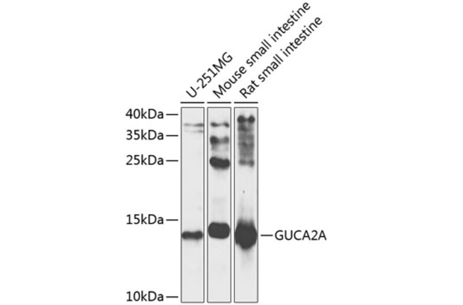 Western Blot - Anti-Guanylin Antibody (A16341) - Antibodies.com