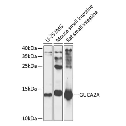 Western Blot - Anti-Guanylin Antibody (A16341) - Antibodies.com