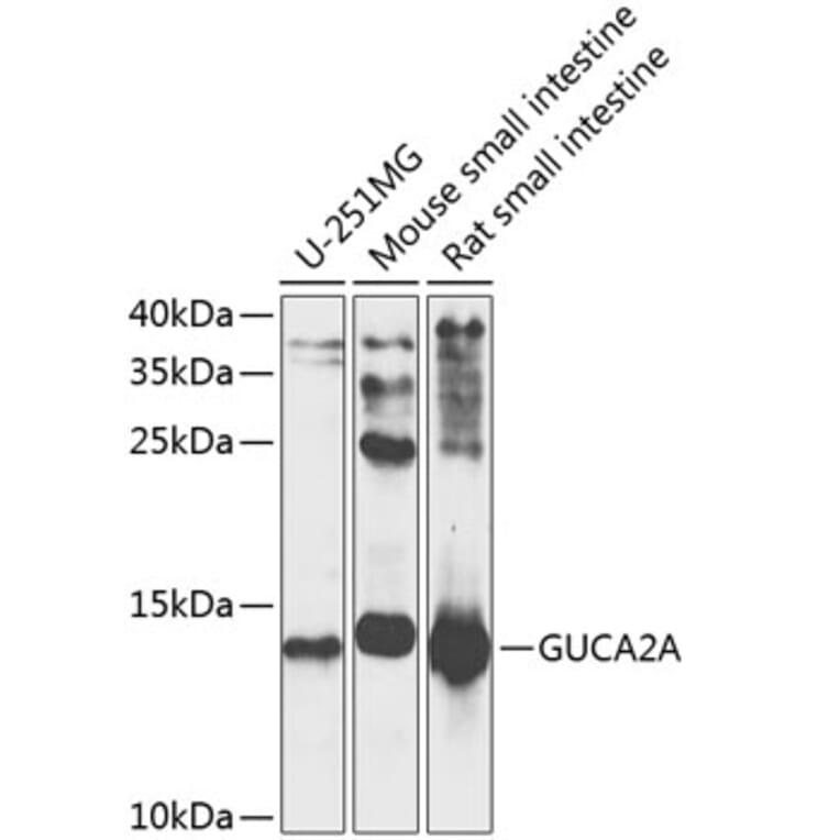 Western Blot - Anti-Guanylin Antibody (A16341) - Antibodies.com