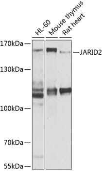 Western blot analysis of extracts of various cell lines, using Anti-JARID2 Antibody (A9823) at 1:1,000 dilution.
Secondary antibody: Goat Anti-Rabbit IgG (H+L) (HRP) (AS014) at 1:10,000 dilution.
Lysates / proteins: 25µg per lane.
Blocking buffer: 3% non-fat dry milk in TBST.
Detection: ECL Basic Kit (RM00020).
Exposure time: 10s.