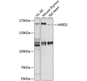 Western Blot - Anti-Jarid2 Antibody (A16342) - Antibodies.com