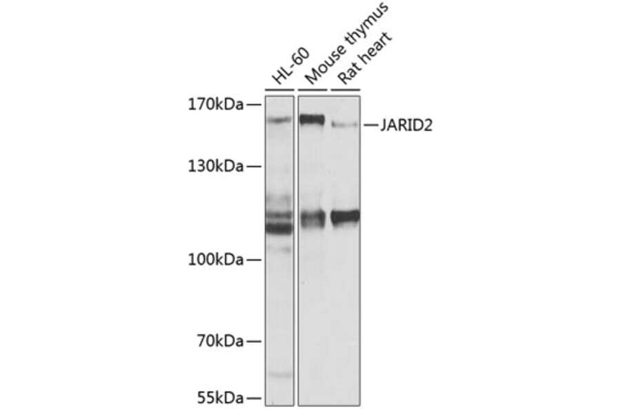 Western Blot - Anti-Jarid2 Antibody (A16342) - Antibodies.com