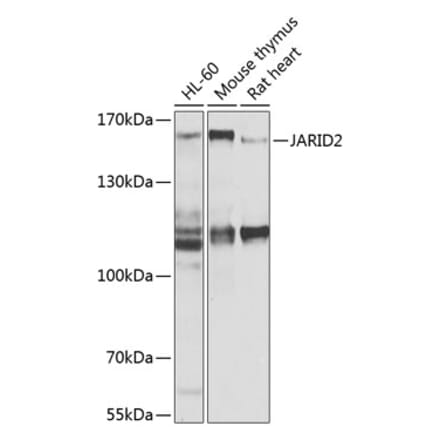 Western Blot - Anti-Jarid2 Antibody (A16342) - Antibodies.com