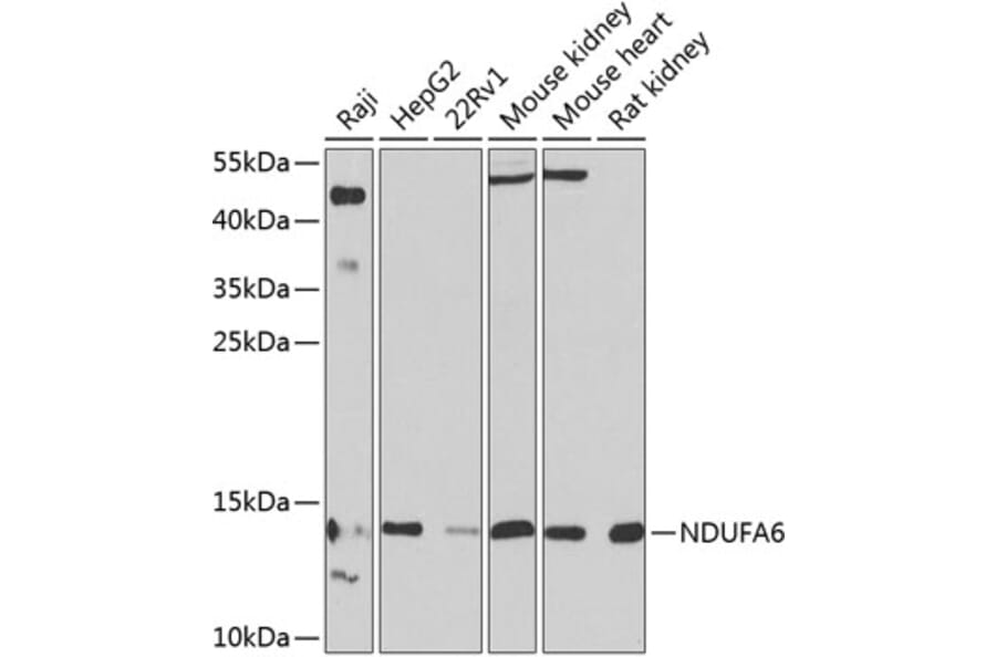 Western Blot - Anti-NDUFA6 Antibody (A16344) - Antibodies.com