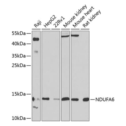 Western Blot - Anti-NDUFA6 Antibody (A16344) - Antibodies.com