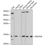 Western Blot - Anti-NDUFA6 Antibody (A16344) - Antibodies.com
