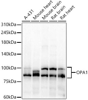 Western blot analysis of extracts of various cell lines, using Anti-OPA1 Antibody (A9833) at 1:1,000 dilution.
Secondary antibody: Goat Anti-Rabbit IgG (H+L) (HRP) (AS014) at 1:10,000 dilution.
Lysates / proteins: 25µg per lane.
Blocking buffer: 3% non-fat dry milk in TBST.
Detection: ECL Basic Kit (RM00020).
Exposure time: 10s.
