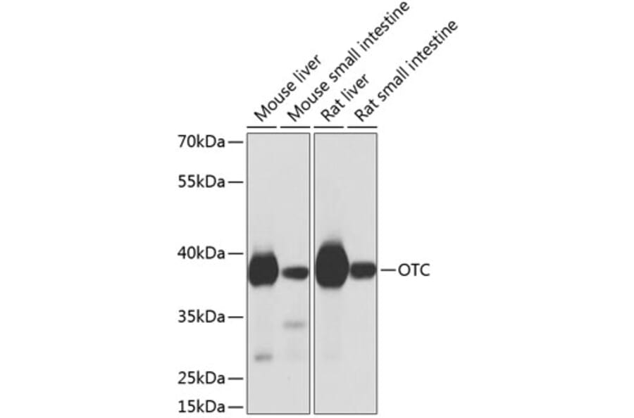 Western Blot - Anti-Ornithine Carbamoyltransferase/OTC Antibody (A16346) - Antibodies.com