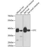 Western Blot - Anti-Ornithine Carbamoyltransferase/OTC Antibody (A16346) - Antibodies.com