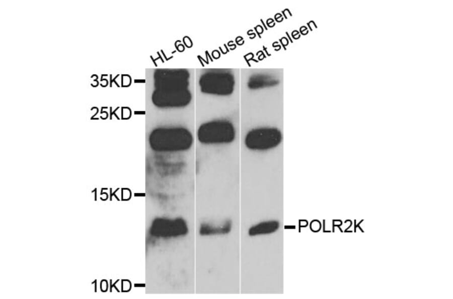Western Blot - Anti-POLR2K Antibody (A9836) - Antibodies.com