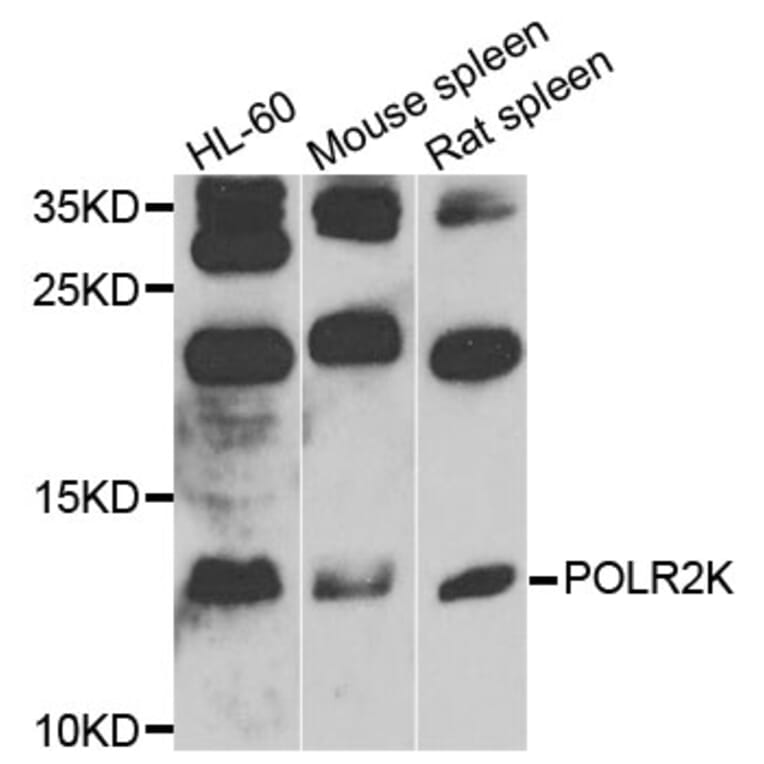 Western Blot - Anti-POLR2K Antibody (A9836) - Antibodies.com