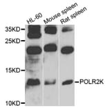 Western Blot - Anti-POLR2K Antibody (A9836) - Antibodies.com