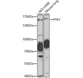 Western Blot - Anti-CCK4 Antibody (A16348) - Antibodies.com