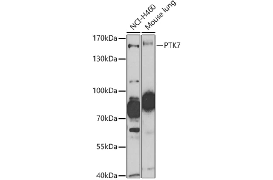 Western Blot - Anti-CCK4 Antibody (A16348) - Antibodies.com