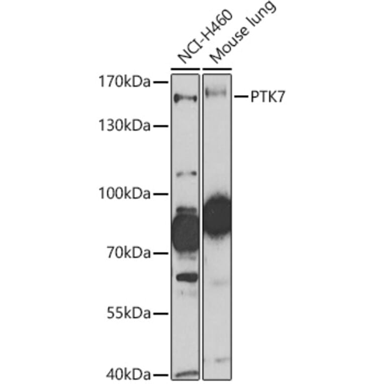 Western Blot - Anti-CCK4 Antibody (A16348) - Antibodies.com