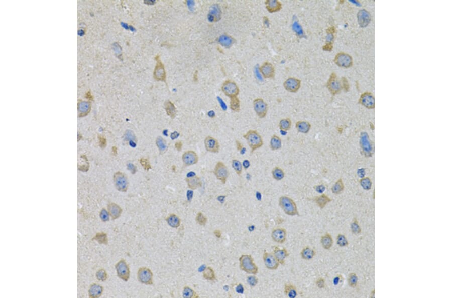 Immunohistochemistry - Anti-CCK4 Antibody (A16348) - Antibodies.com