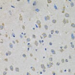 Immunohistochemistry - Anti-CCK4 Antibody (A16348) - Antibodies.com
