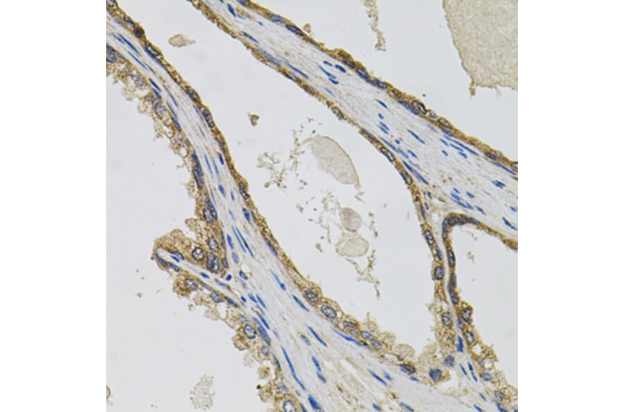 Immunohistochemistry - Anti-CCK4 Antibody (A16348) - Antibodies.com