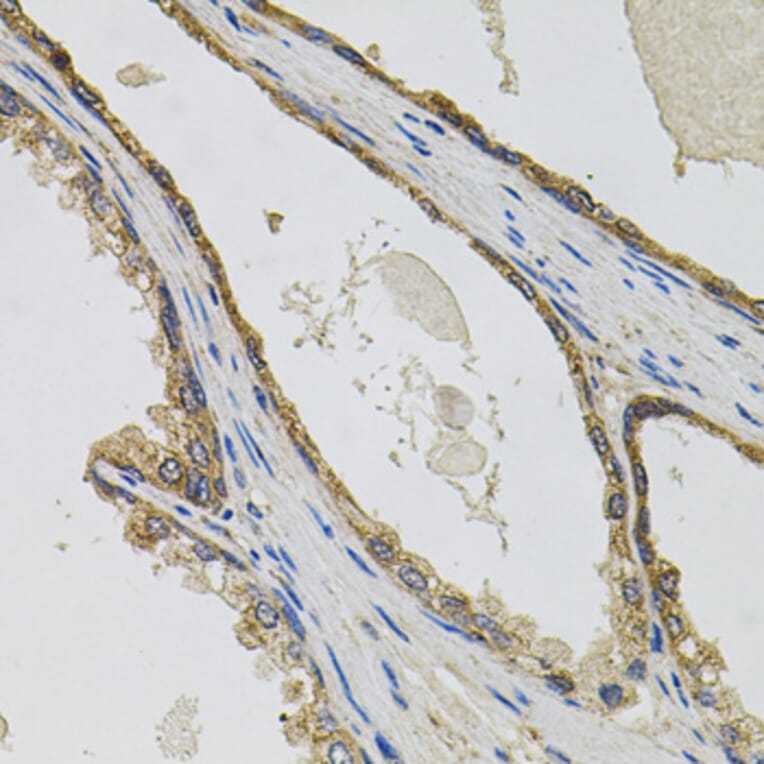Immunohistochemistry - Anti-CCK4 Antibody (A16348) - Antibodies.com